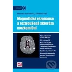Magnetická rezonance a roztroušená skleróza mozkomíšní - Manuela Vančurová