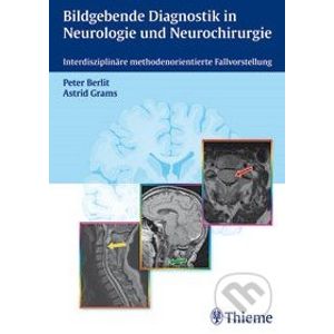 Bildgebende Diagnostik in der Neurologie und Neurochirurgie - Peter Berlit
