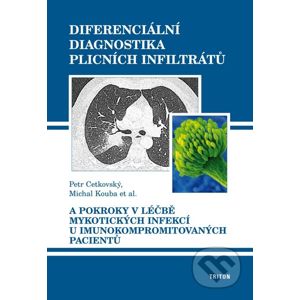 Diferenciální diagnostika plicních infiltrátů - Petr Cetkovský, Michal Kouba a kol.