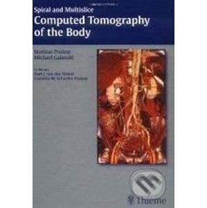 Spiral and Multislice Computed Tomography of the Body - Mathias Prokop